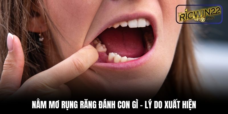 Nằm mơ rụng răng đánh con gì - Lý do xuất hiện
