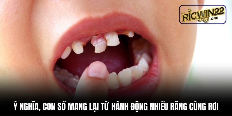 Ý nghĩa, con số mang lại từ hành động nhiều răng cùng rơi