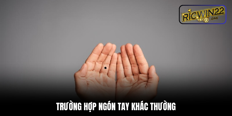 Trường hợp ngón tay khác thường